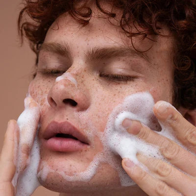 Blackheads