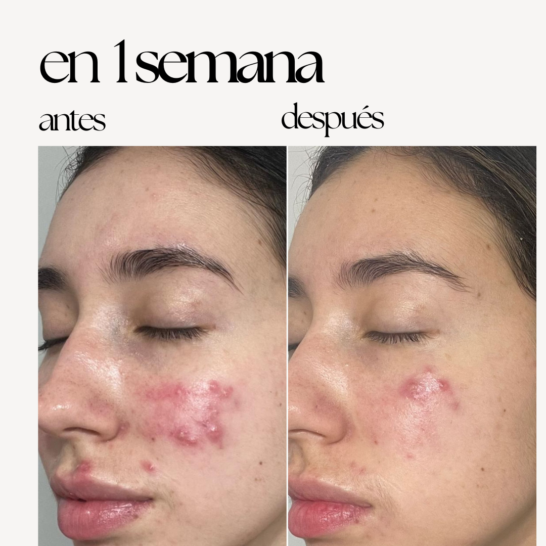 REDNESS CONTROL CREAM