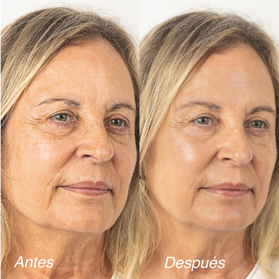SET – NO MAKE UP