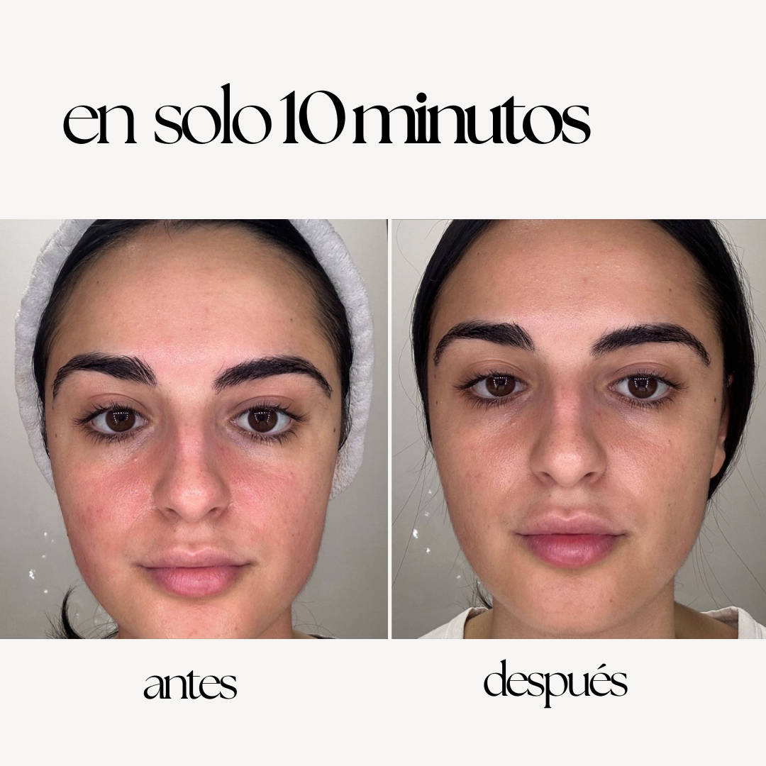 REDNESS CONTROL CREAM