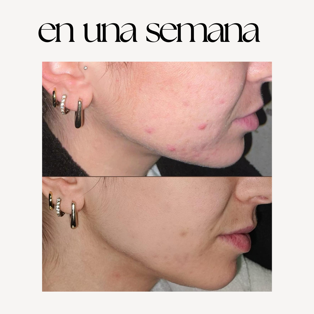 SOS IMPERFECCIONES