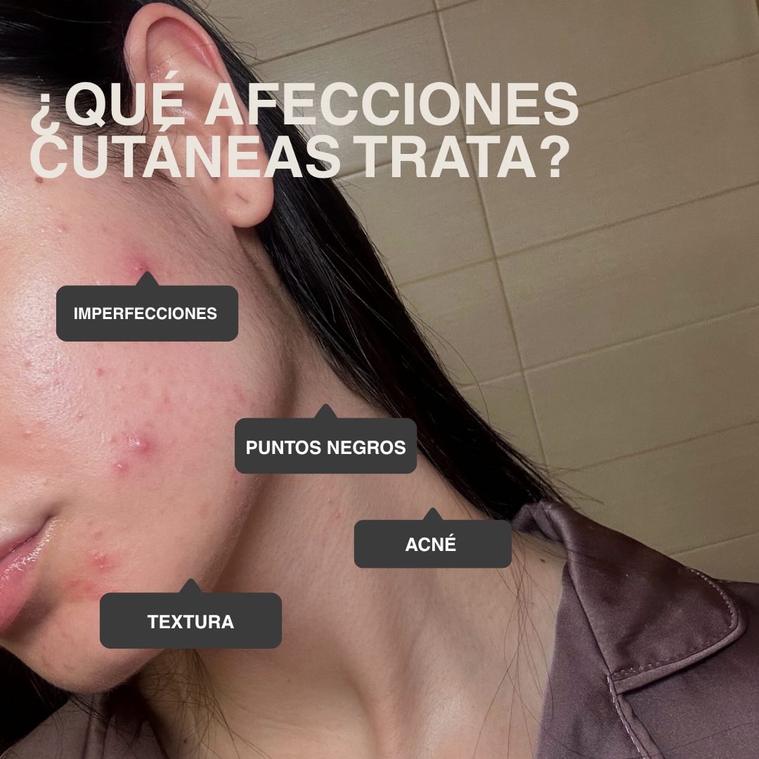 TÓNICO PURIFICANTE