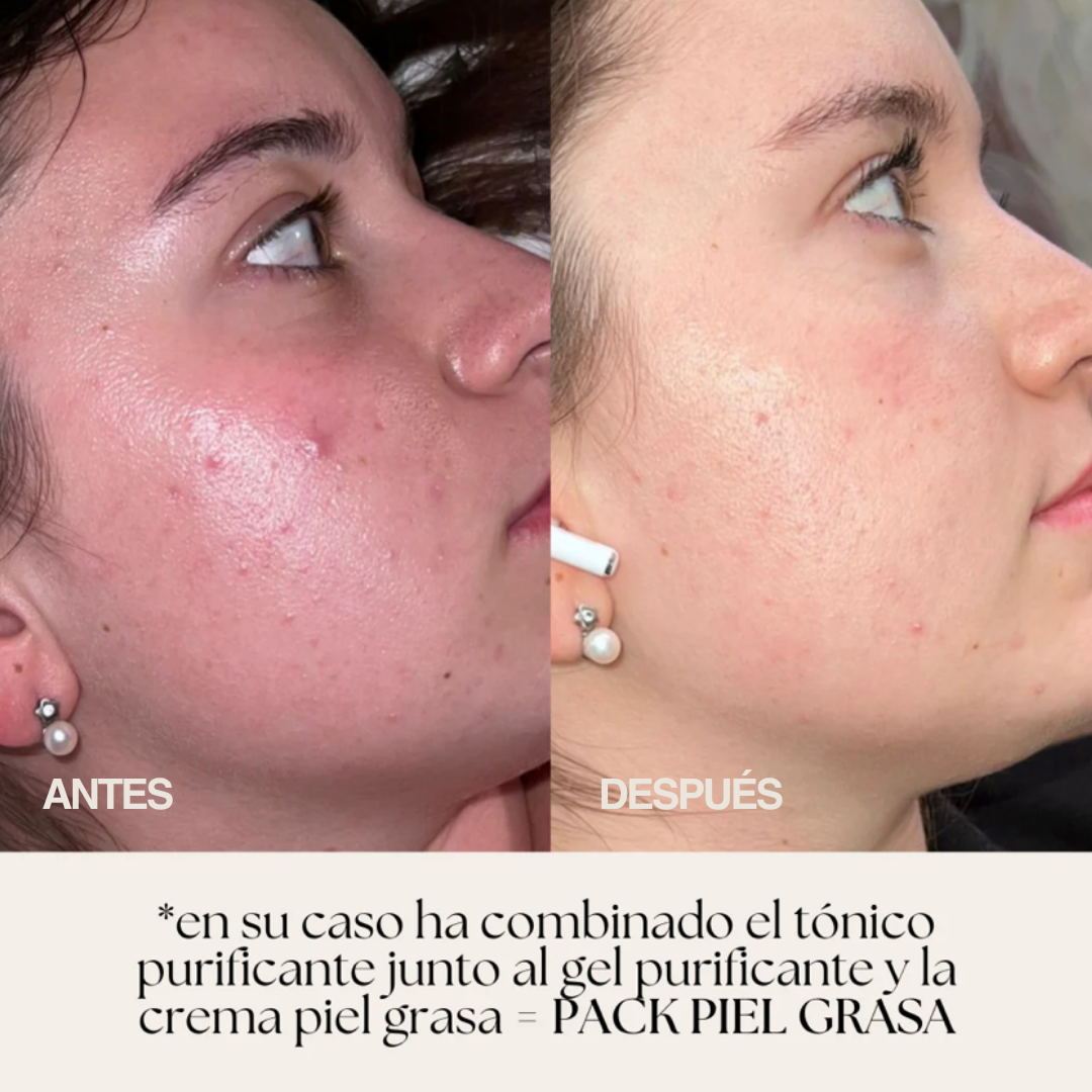PACK - PERFECT SKIN BY EAC