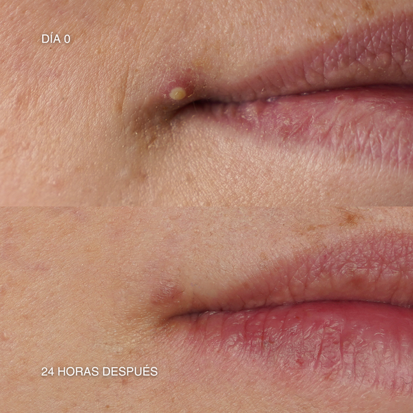 SOS Imperfecciones